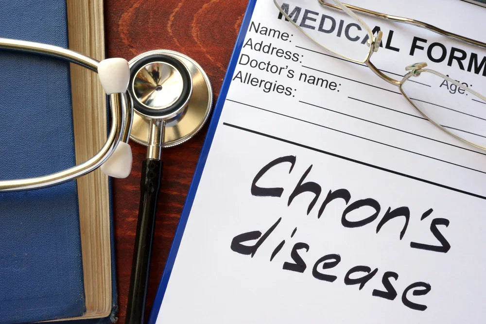 Understanding Crohn’s Disease: Causes, Lifestyle Changes, and Supplements